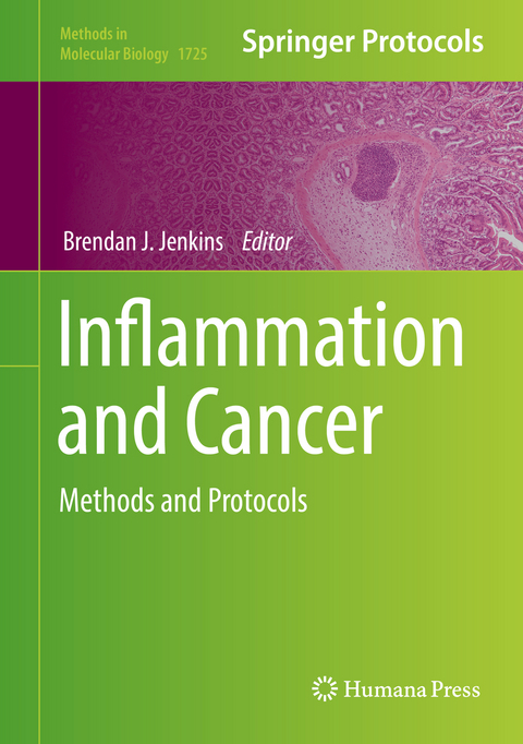 Inflammation and Cancer - 