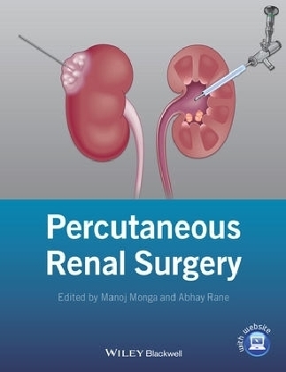 Percutaneous Renal Surgery - Manoj Monga, Abhay Rane