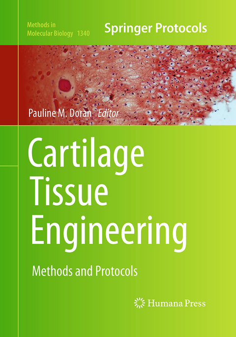 Cartilage Tissue Engineering - 