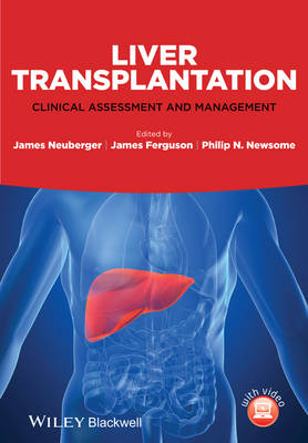 Liver Transplantation - 