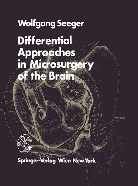 Differential Approaches in Microsurgery of the Brain - W. Seeger