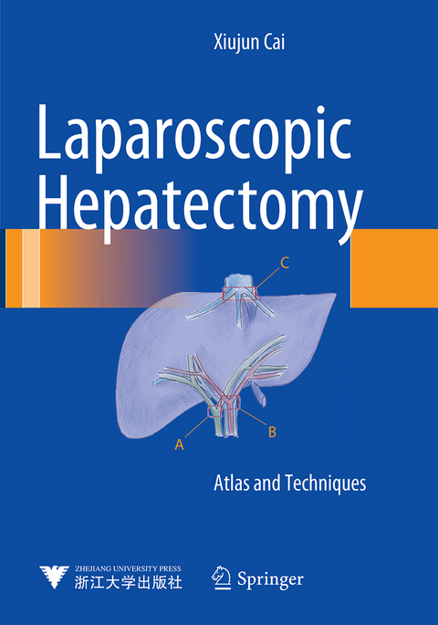 Laparoscopic Hepatectomy - Xiujun Cai