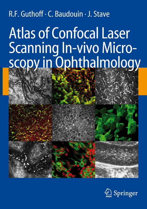 Atlas of Confocal Laser Scanning In-vivo Microscopy in Ophthalmology - R.F. Guthoff, C. Baudouin, J. Stave