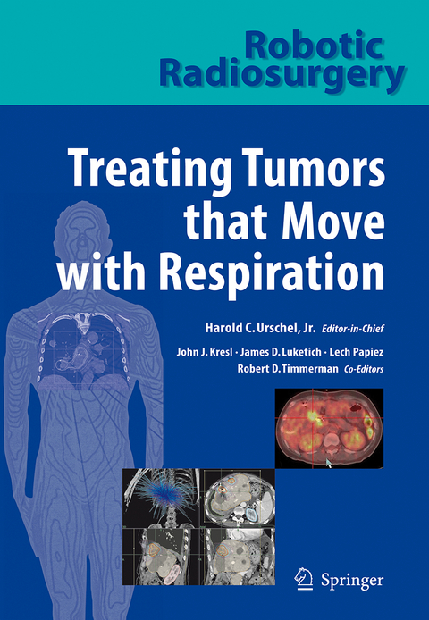 Robotic Radiosurgery. Treating Tumors that Move with Respiration - 