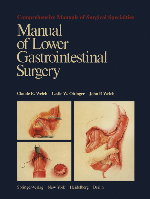 Manual of Lower Gastrointestinal Surgery - Claude E. Welch, Leslie W. Ottinger, John P. Welch