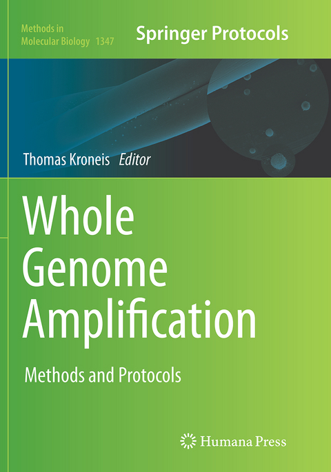 Whole Genome Amplification - 