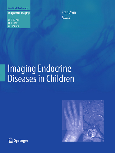 Imaging Endocrine Diseases in Children - 