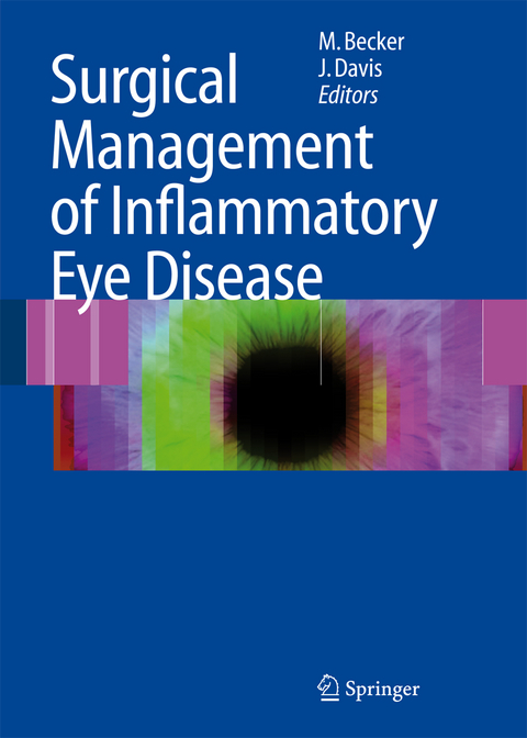 Surgical Management of Inflammatory Eye Disease - 