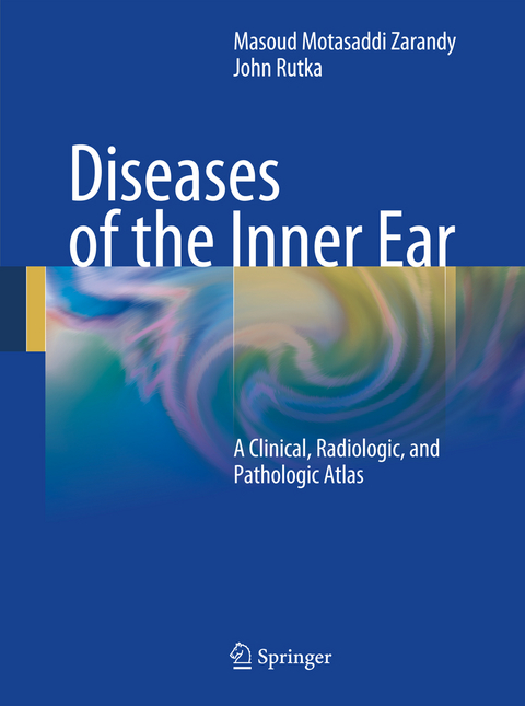 Diseases of the Inner Ear - 