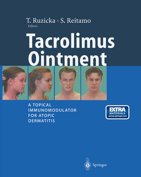 Tacrolimus Ointment - 