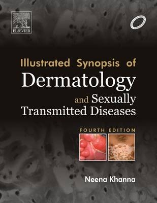 Illustrated Synopsis of Dermatology & Sexually Transmitted Diseases - Neena Khanna