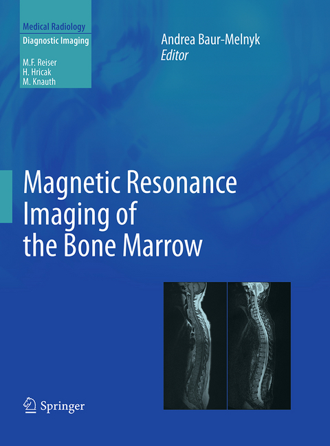 Magnetic Resonance Imaging of the Bone Marrow - 