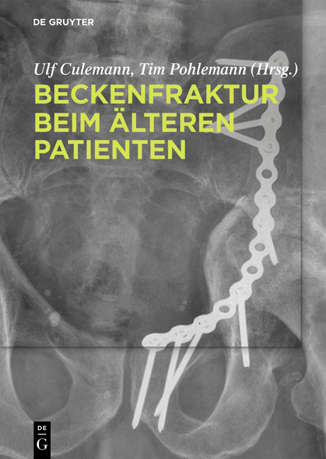 Beckenfraktur beim älteren Patienten - 