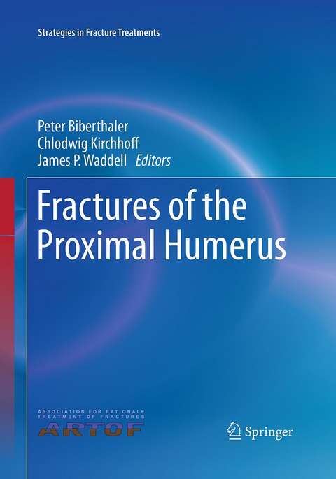 Fractures of the Proximal Humerus - 