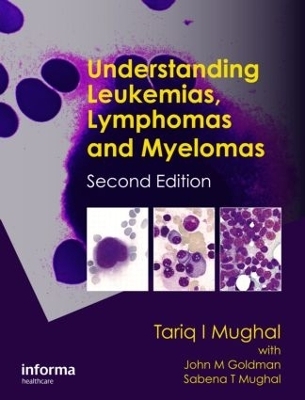 Understanding Leukemias, Lymphomas and Myelomas - Tariq I. Mughal