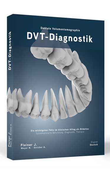 DVT-Diagnostik - Jonathan Fleiner, Nils Weyer, Andres Stricker