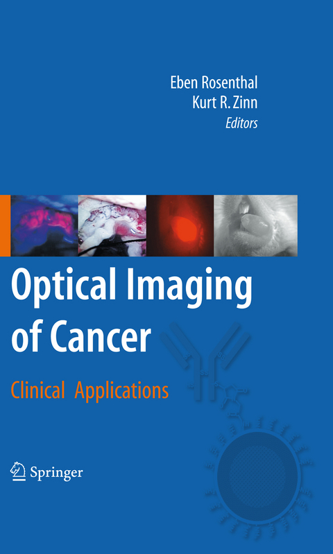 Optical Imaging of Cancer - 