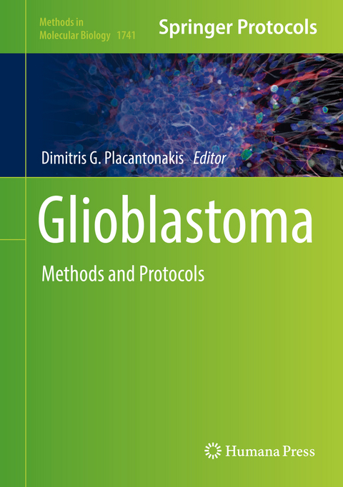 Glioblastoma - 