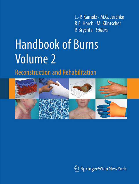 Handbook of Burns Volume 2 - 