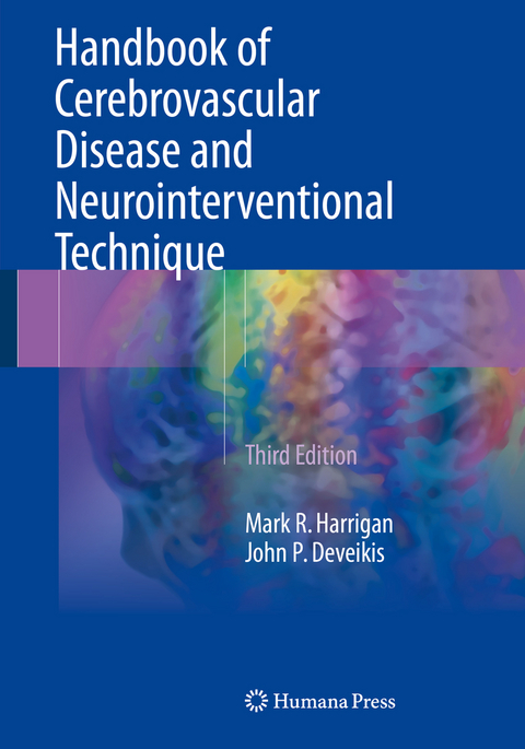 Handbook of Cerebrovascular Disease and Neurointerventional Technique - Mark R. Harrigan, John P. Deveikis