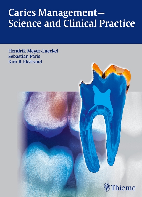 Caries Management - Science and Clinical Practice - Hendrik Meyer-Lückel, Sebastian Paris, Kim Ekstrand