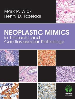 Neoplastic Mimics in Thoracic and Cardiovascular Pathology - Mark R. Wick, Henry D. Tazelaar