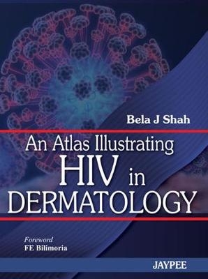 An Atlas Illustrating HIV in Dermatology - Bela J Shah