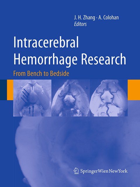 Intracerebral Hemorrhage Research - 