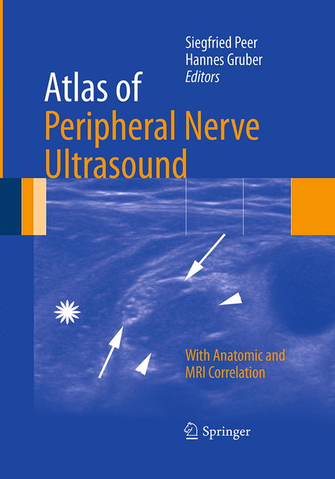 Atlas of Peripheral Nerve Ultrasound - 