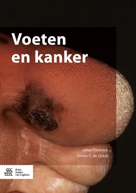 Voeten En Kanker - Johan Toonstra, Anton C De Groot