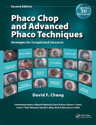 Phaco Chop and Advanced Phaco Techniques - David F. Chang