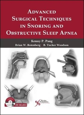 Advanced Surgical Techniques in Snoring and Obstructive Sleep Apnea - 