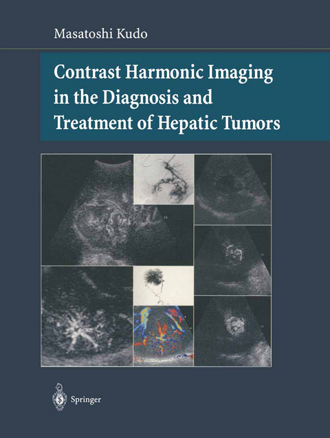 Contrast Harmonic Imaging in the Diagnosis and Treatment of Hepatic Tumors - Masatoshi Kudo