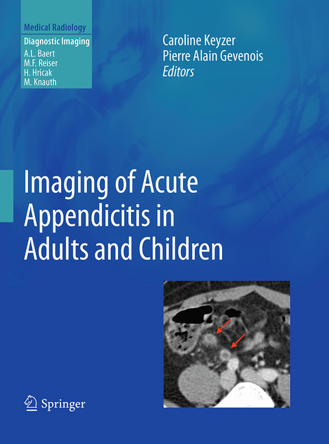 Imaging of Acute Appendicitis in Adults and Children - 