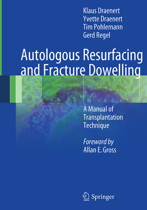 Autologous Resurfacing and Fracture Dowelling - Klaus Draenert, Yvette Draenert, Tim Pohlemann, Gerd Regel