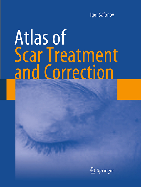 Atlas of Scar Treatment and Correction - Igor Safonov