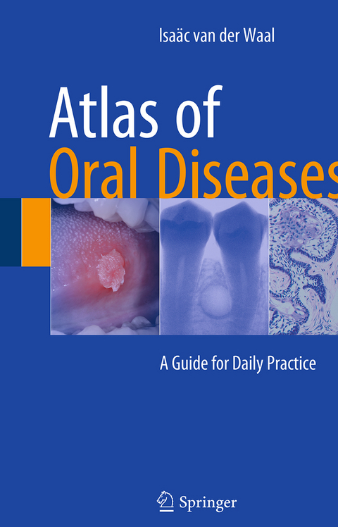 Atlas of Oral Diseases - Isaäc van der Waal