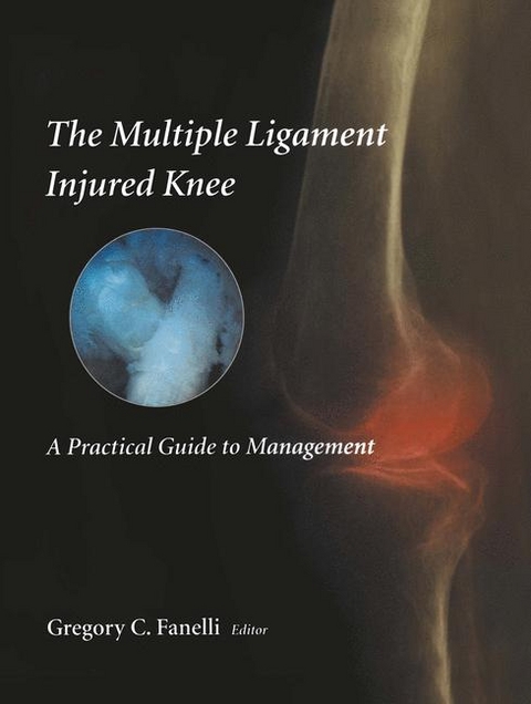 The Multiple Ligament Injured Knee - 