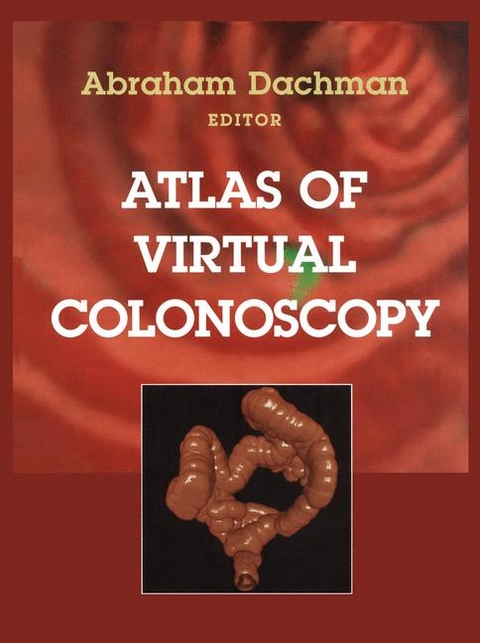 Atlas of Virtual Colonoscopy - 