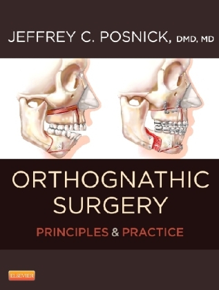 Orthognathic Surgery - 2 Volume Set - Jeffrey C. Posnick