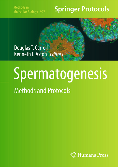 Spermatogenesis - 