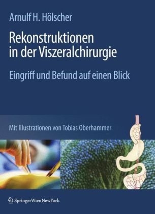 Rekonstruktionen in der Viszeralchirurgie - 