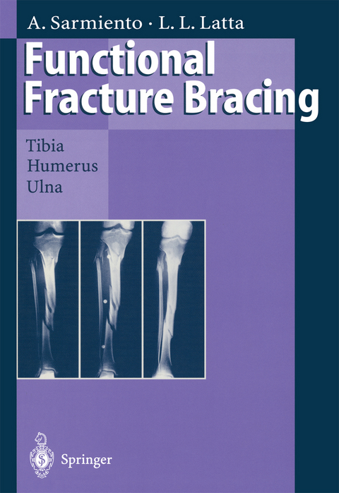 Functional Fracture Bracing - Augusto Sarmiento, Loren L. Latta