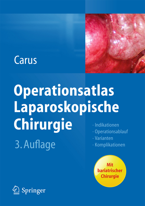 Operationsatlas Laparoskopische Chirurgie - Thomas Carus