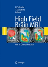 High Field Brain MRI - 