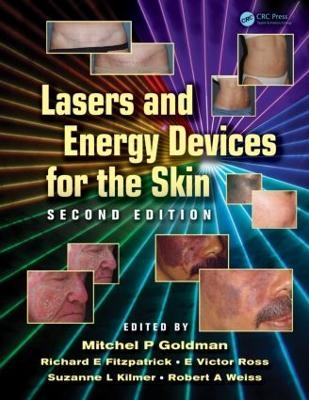 Lasers and Energy Devices for the Skin - 