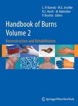 Handbook of Burns Volume 2 - 