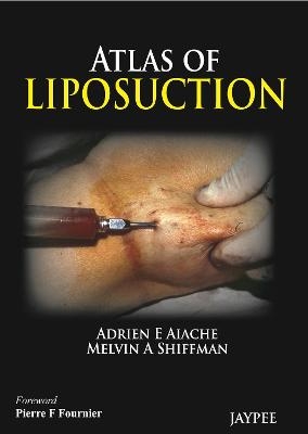 Atlas of Liposuction - Adrien E Aiache, Melvin A Shiffman