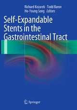 Self-Expandable Stents in the Gastrointestinal Tract - 