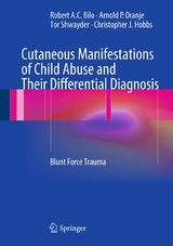 Cutaneous Manifestations of Child Abuse and Their Differential Diagnosis - Robert A.C. Bilo, Arnold P. Oranje, Tor Shwayder, Christopher J. Hobbs